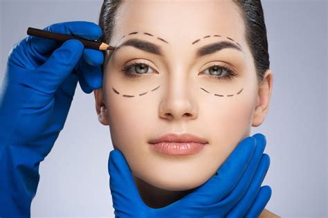 blefaroplastika-v-ekaterinburge-2