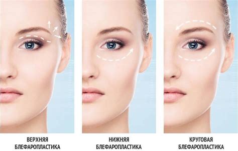 blefaroplastika-v-izhevske-2