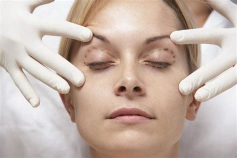 blefaroplastika-v-mogileve-2