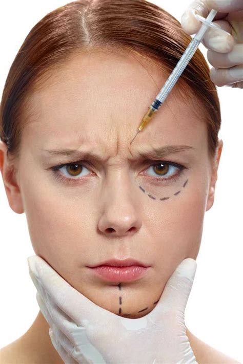 botoks-i-blefaroplastika-mozhno-li-sovmestit